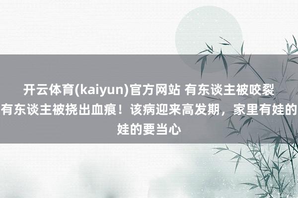 开云体育(kaiyun)官方网站 有东谈主被咬裂指甲，有东谈主被挠出血痕！该病迎来高发期，家里有娃的要当心